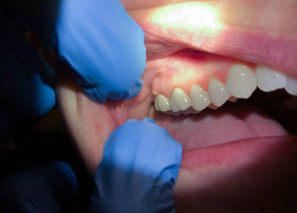 Best Pediatric Emergency Dentist in Gurdon, AR